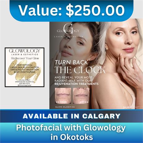 Photofacial with Glowology in Okotoks