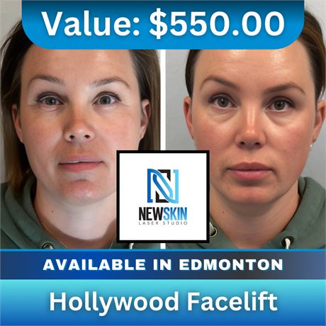 Hollywood Facelift