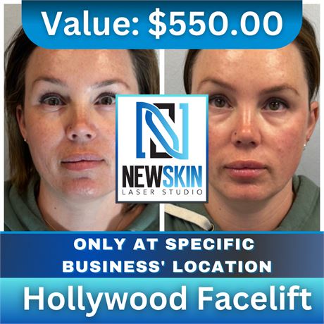 Hollywood Facelift