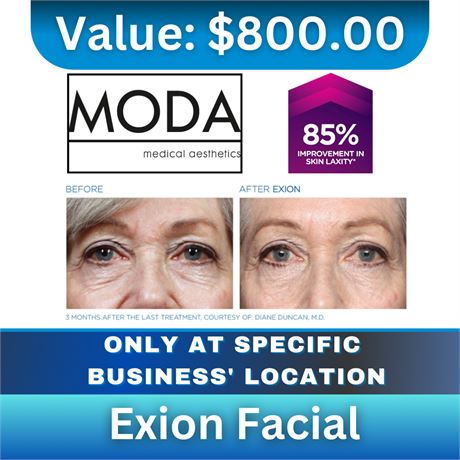 Exion Facial