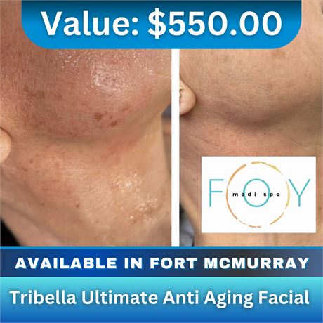 Tribella Ultimate Anti Aging Facial