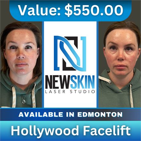 Hollywood Facelift