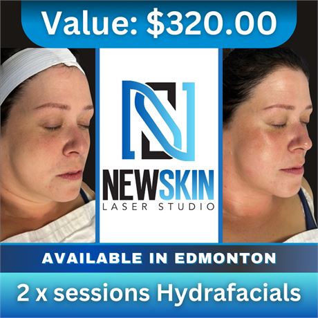 2 x sessions Hydrafacials