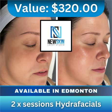 2 x sessions Hydrafacials