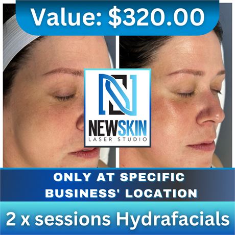 2 x sessions Hydrafacials