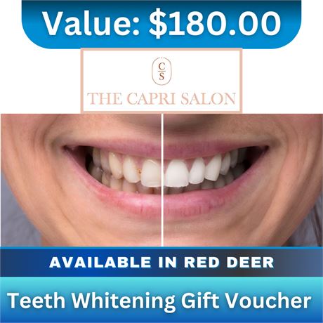 Teeth Whitening Gift Voucher