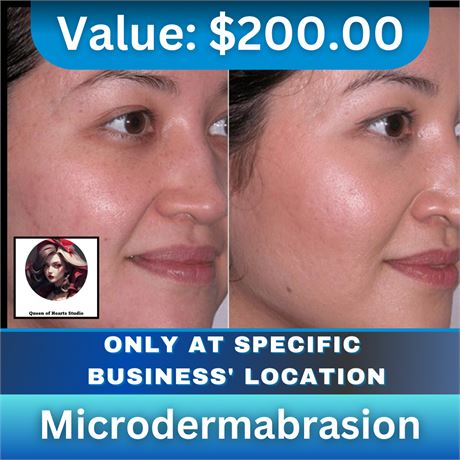 Microdermabrasion at Queen of Hearts Studio